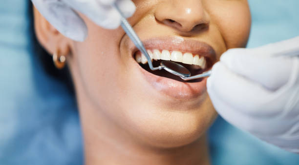 Best Emergency Wisdom Teeth Removal in Allendale, CA